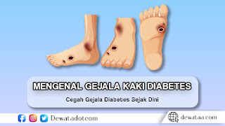 Mengenal20Kaki20Diabetes20Gejala20dan20Tindakan20Pencegahan20yang20Perlu20Diperhatikan 1